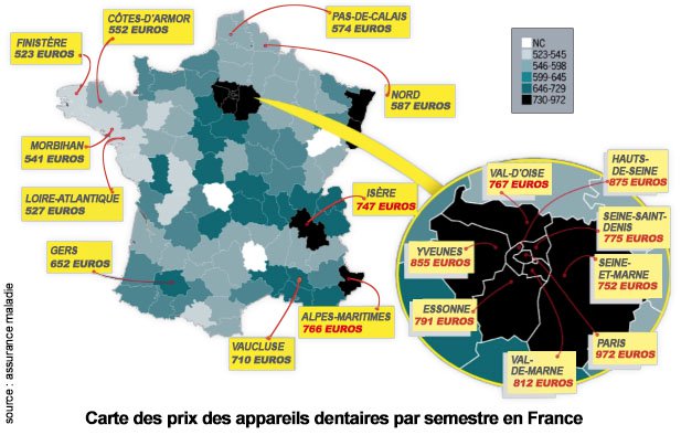 Carte des prix des appareils dentaires par semestre en France