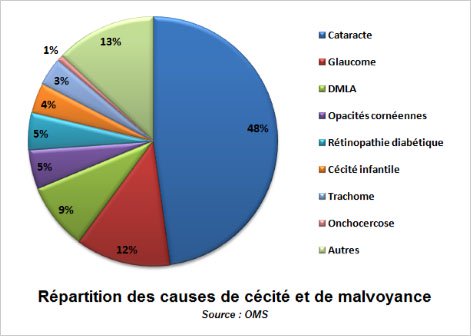 Répartition des causes de cécité et de malvoyance