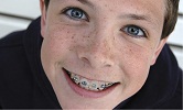 remboursement orthodontie – mutuelle